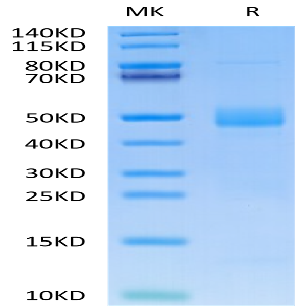 Human CTGF/CCN2 Protein (CGF-HM101)