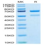 Human CTGF/CCN2 Protein (CGF-HM201)