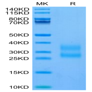 Biotinylated Human CTGF/CCN2 Protein (CGF-HM401B)