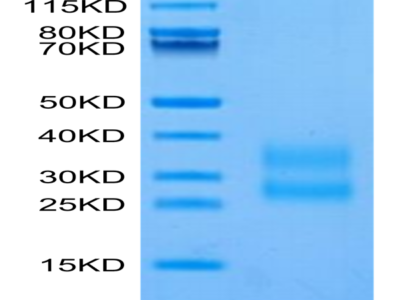 Biotinylated Human CTGF/CCN2 Protein (CGF-HM401B)