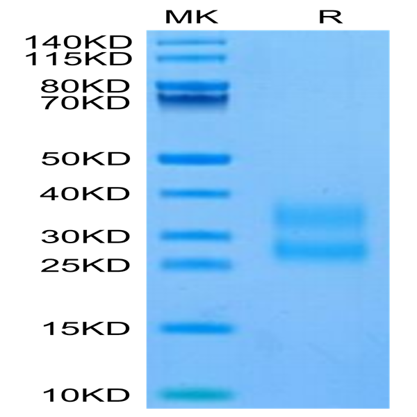 Biotinylated Human CTGF/CCN2 Protein (CGF-HM401B) Biotinylated Human CTGF/CCN2 Protein (CGF-HM401B)