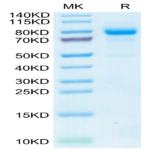 Human CDH6/Cadherin-6 Protein (CHD-HM106)
