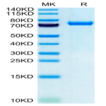 Human CLEC2D Protein (CLD-HM52D)