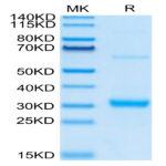 Human CLEC10A Protein (CLE-HM10A)
