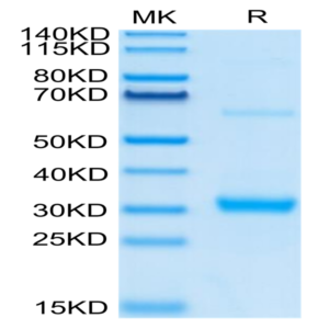 Human CLEC10A Protein (CLE-HM10A)