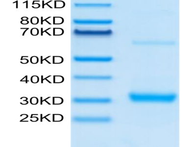 Human CLEC10A Protein (CLE-HM10A)