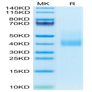 Human CLEC10A Protein (CLE-HM10B)