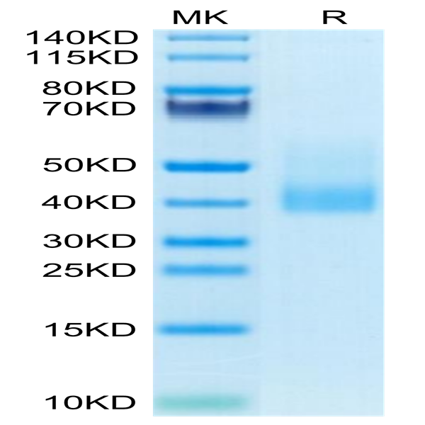 Human CLEC10A Protein (CLE-HM10B)