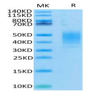 Human CLEC12A/MICL/CLL-1 Protein (CLE-HM12A)