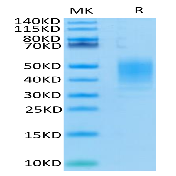 Human CLEC12A/MICL/CLL-1 Protein (CLE-HM12A)