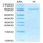 Human CLEC14A Protein (CLE-HM14A)