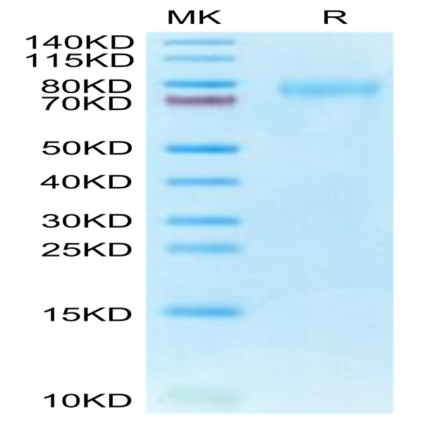 Human CLEC14A Protein (CLE-HM14A)