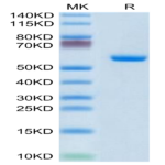 Human CLEC4A/DCIR Protein (CLE-HM24A)