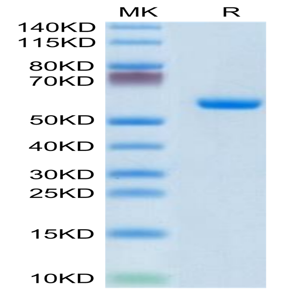 Human CLEC4A/DCIR Protein (CLE-HM24A)