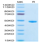 Human CLEC7A Protein (CLE-HM27A)