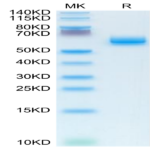 Human CLEC9A Protein (CLE-HM29A)