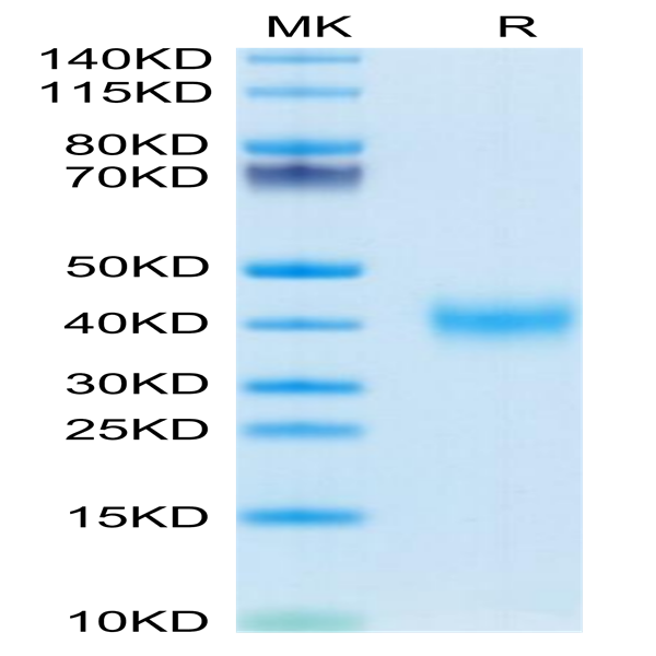 Mouse CLEC10A Protein (CLE-MM10A)