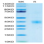Human Clusterin Protein (CLN-HM101)