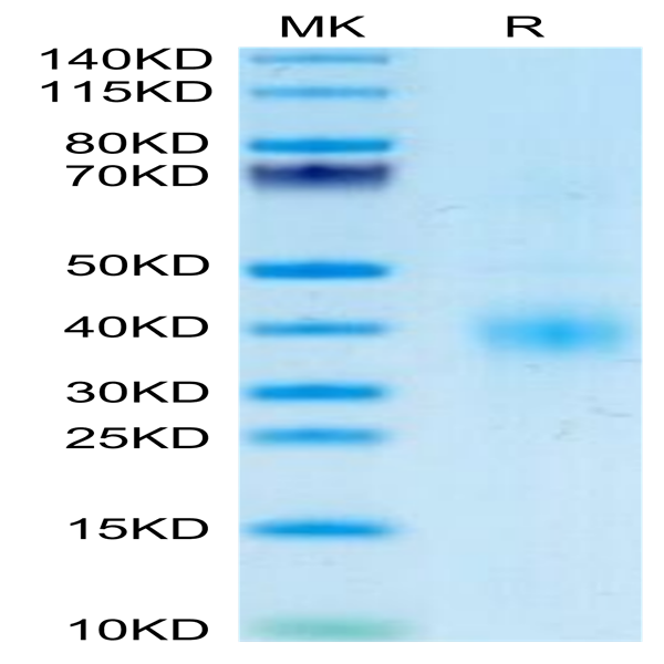 Human Clusterin Protein (CLN-HM101)