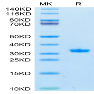 SARS-CoV-2 3CLpro/3C-like Protease Protein (Q189K) (COV-VE0LA)