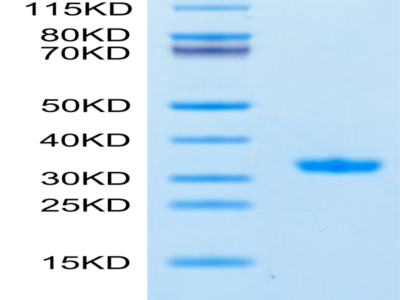 SARS-CoV-2 3CLpro/3C-like Protease Protein (Q189K) (COV-VE0LA)