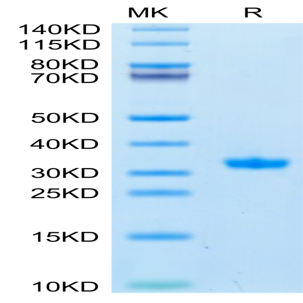SARS-CoV-2 3CLpro/3C-like Protease Protein (Q189K) (COV-VE0LA) SARS-CoV-2 3CLpro/3C-like Protease Protein (Q189K) (COV-VE0LA)