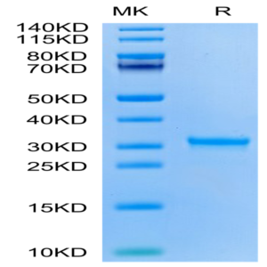 SARS-CoV-2 3CLpro/3C-like Protease Protein (H172Y) (COV-VE0LB)