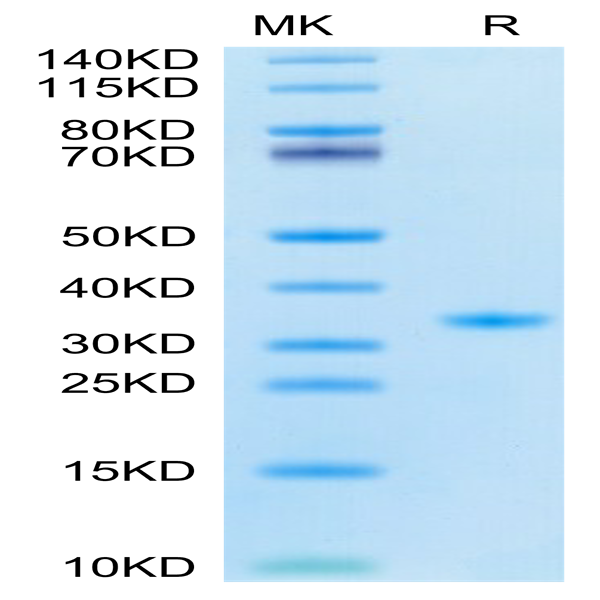 SARS-CoV-2 3CLpro/3C-like Protease Protein (F140A) (COV-VE0LD)