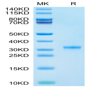SARS-CoV-2 3CLpro/3C-like Protease Protein (P132H) (COV-VE0LE)