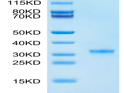 SARS-CoV-2 3CLpro/3C-like Protease Protein (P132H) (COV-VE0LE)