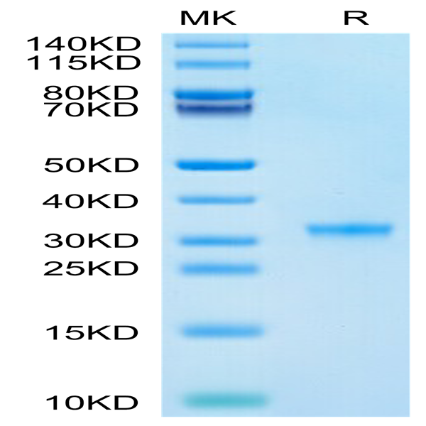 SARS-CoV-2 3CLpro/3C-like Protease Protein (P132H) (COV-VE0LE) SARS-CoV-2 3CLpro/3C-like Protease Protein (P132H) (COV-VE0LE)