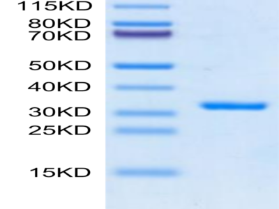 SARS-CoV-2 3CLpro/3C-like Protease Protein (E166V) (COV-VE0LK)