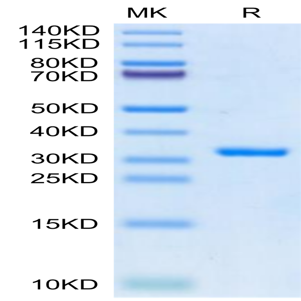 SARS-CoV-2 3CLpro/3C-like Protease Protein (E166V) (COV-VE0LK) SARS-CoV-2 3CLpro/3C-like Protease Protein (E166V) (COV-VE0LK)