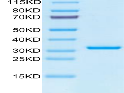 SARS-CoV-2 3CLpro/3C-like Protease Protein (L50F