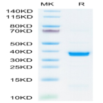 SARS-COV-2 PLpro/papain-like protease Protein (COV-VE1PL)