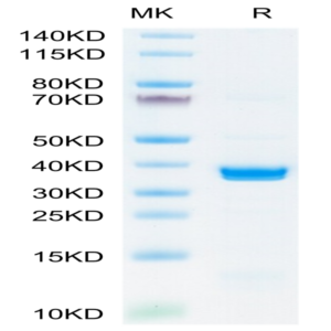 SARS-COV-2 PLpro/papain-like protease Protein (COV-VE1PL)