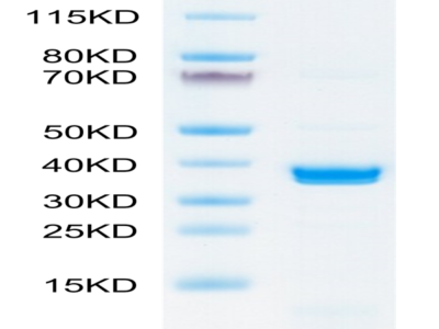 SARS-COV-2 PLpro/papain-like protease Protein (COV-VE1PL)