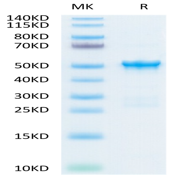 SARS-COV-2 Nucleocapsid Protein (COV-VE4NP) SARS-COV-2 Nucleocapsid Protein (COV-VE4NP)