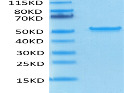 Bioytinylated SARS-COV-2 Nucleocapsid Protein (COV-VE4NPB)