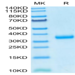 SARS-COV-2 Spike RBD (N501Y) Protein (COV-VM1BY)