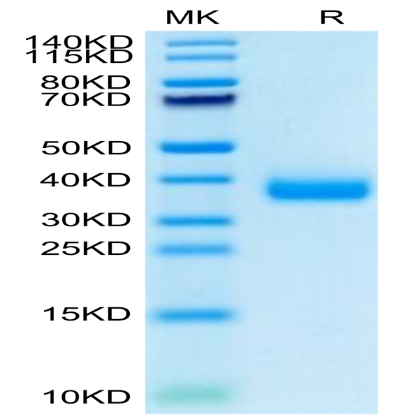 SARS-COV-2 Spike RBD (Omicron B.1.1.529) Protein (COV-VM1RO)