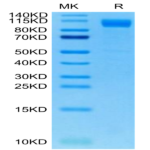 SARS-COV-2 Spike S1 (Deltacron) Protein (COV-VM1SD)