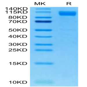 SARS-COV-2 Spike S1 (Deltacron) Protein (COV-VM1SD)