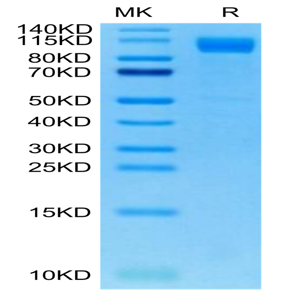 SARS-COV-2 Spike S1 (Deltacron) Protein (COV-VM1SD)