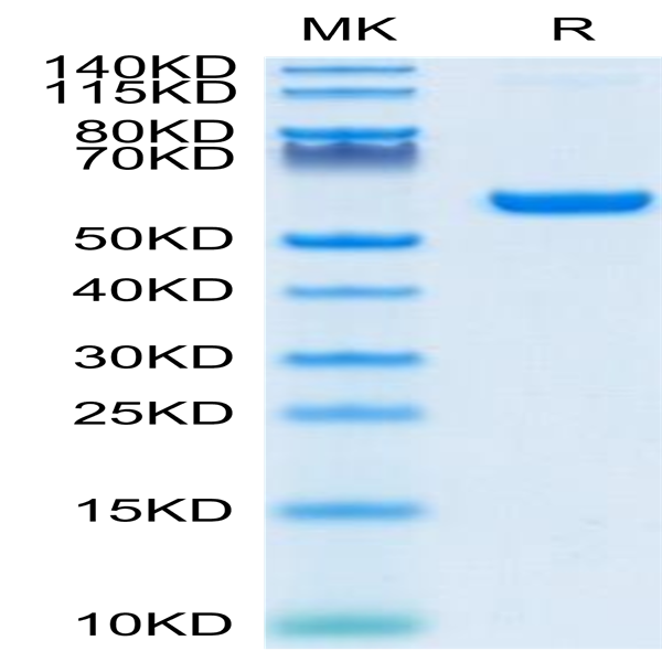 SARS-COV-2 Spike RBD Protein (COV-VM2BD)