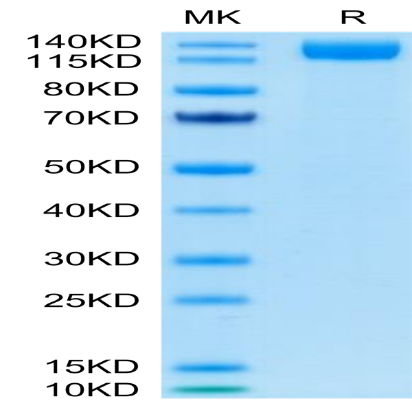 SARS-COV-2 Spike S1 Protein (COV-VM2S1)