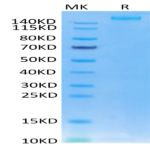 SARS-COV-2 Spike S Trimer Protein (COV-VM2SS)
