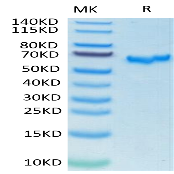 SARS-COV-2 Spike RBD Protein (COV-VM3BD)