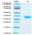 SARS-COV-2 Spike RBD Protein (COV-VM4BD)