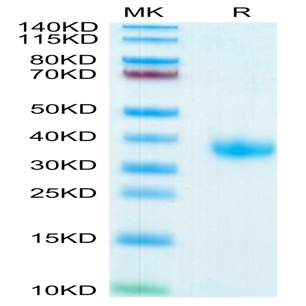 SARS-COV-2 Spike RBD Protein (COV-VM4BD)